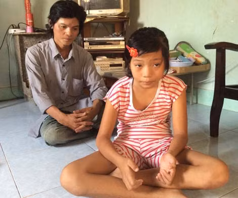 Nhưng khi tháo bìa các tông ra thì tay lại co rút như ban đầu.