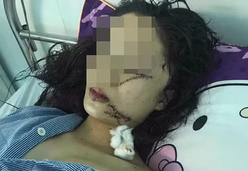 Chị Quỳnh được điều trị tại bệnh viện