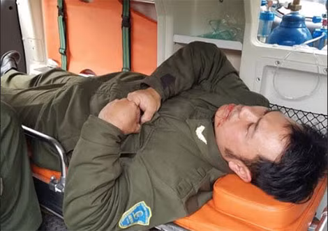 Anh Nguyễn Văn Điệp sau khi bị hành hung.