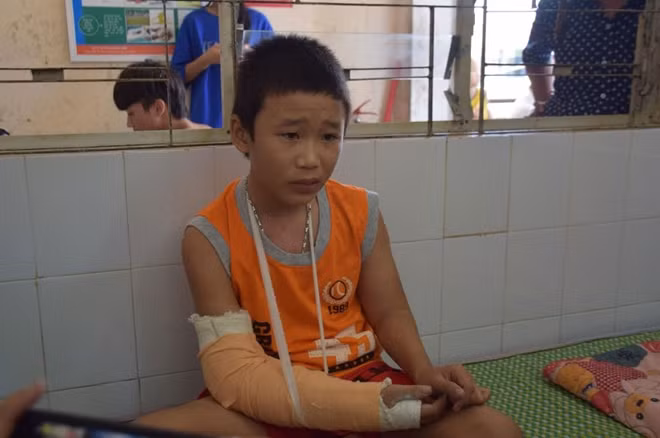 Cháu Linh đang điều trị tại Bệnh viện Đa khoa Quế Sơn.