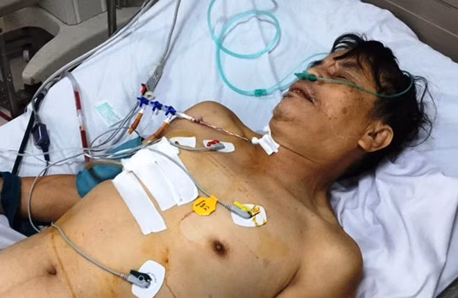 Sau khi được phẫu thuật bệnh nhân Doãn Xuân Khóa đang phục hồi tốt, được chăm sóc tại bệnh viện.