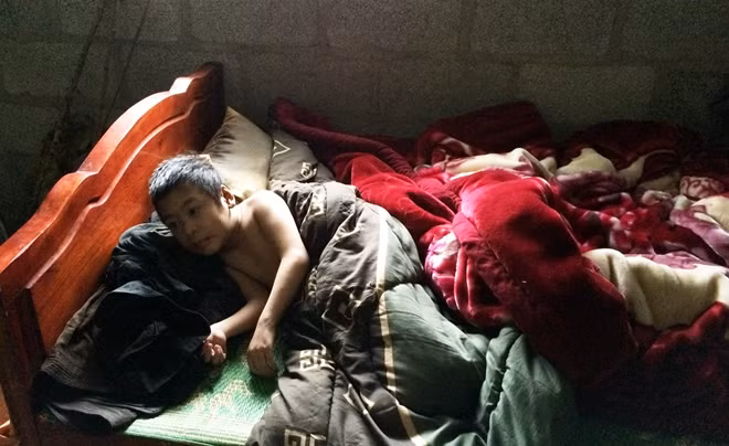 Cuộc sống sinh hoạt của cháu Thào Mí Nô dựa tất cả vào người bố bị thần kinh.
