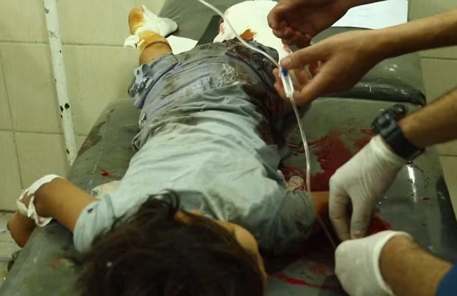 Các bác sĩ Syria đang cấp cứu cho một cháu nhỏ bị thương nặng. Ảnh: SANA