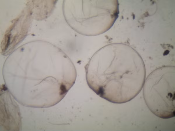 Hình ảnh tảo Noctiluca scintillans dưới kính hiển vi