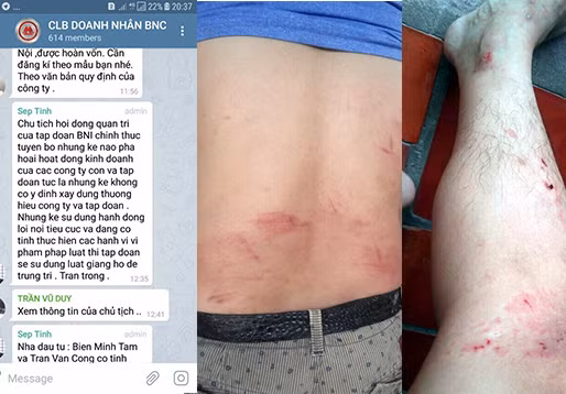 Ông Quý cho biết, nhận được tin nhắn đe dọa và bị hành hung khi trả lời phỏng vấn trên kênh VTV 9 Ông Quý cho biết, nhận được tin nhắn đe dọa và bị hành hung khi trả lời phỏng vấn trên kênh VTV 9