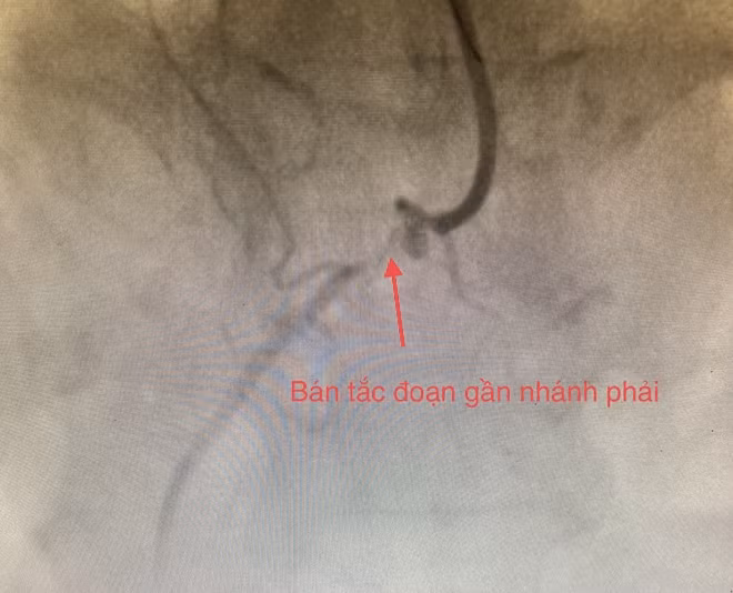 Hình ảnh trước khi can thiệp.