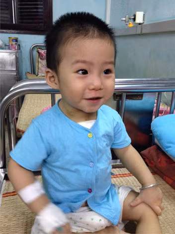Cháu Trương Tuấn Tú tại Bệnh viện Nhi TƯ.