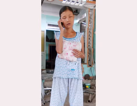 Thân hình nặng 25kg của chị Ý.