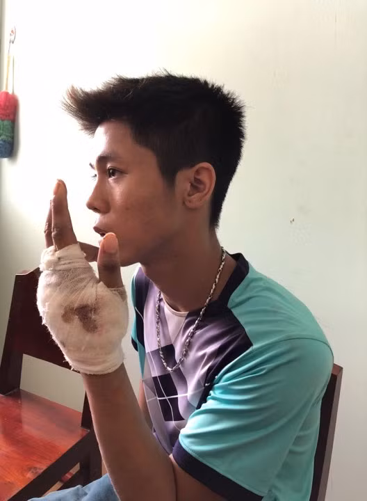 Tình với vết thương ở tay tại cơ quan điều tra Tình với vết thương ở tay tại cơ quan điều tra