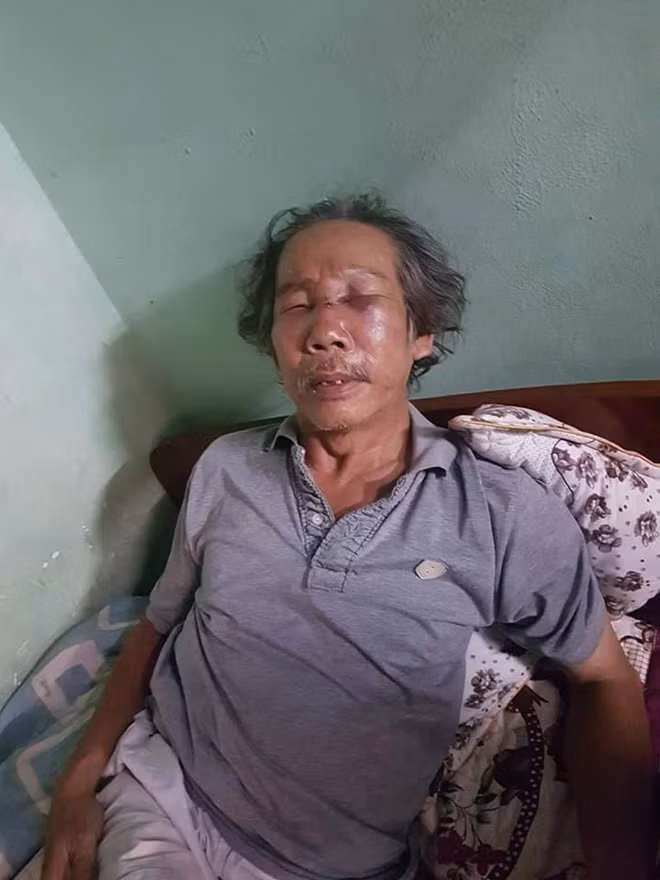 Ông Quang đang chữa trị tại nhà riêng