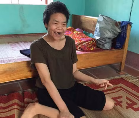 Chất độc da cam khiến Bốn cả ngày chỉ ngẩn ngơ.