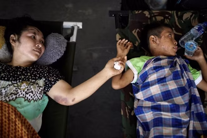 Những vết thương chằng chịt trên khuôn mặt của một cậu bé đang được điều trị khẩn cấp tại lán trại y tế do lực lượng quân đội dựng. Ảnh: Athit Perawongmetha