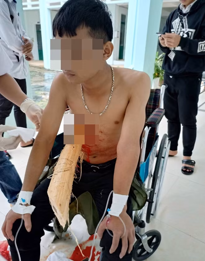 Hình ảnh bệnh nhân Tú khi vừa được đưa đến bệnh viện. Ảnh: BVCC