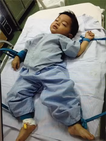 Sức khỏe bé Tiến Thành sau khi được phẫu thuật lấy đinh ra khỏi ruột non đã ổn định chuẩn bị được xuất viện. Sức khỏe bé Tiến Thành sau khi được phẫu thuật lấy đinh ra khỏi ruột non đã ổn định chuẩn bị được xuất viện.
