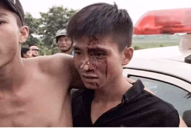 Nam thanh niên được cho là bị đánh trọng thương