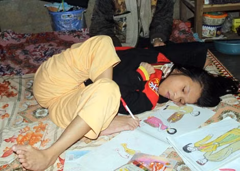 “Cô gái da cam” Huỳnh Thị Thảnh tập viết, vẽ bằng đôi chân tật nguyền.