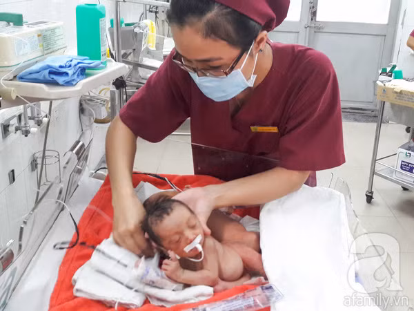 Những em bé song sinh dính nhau ra đời những năm gần đây