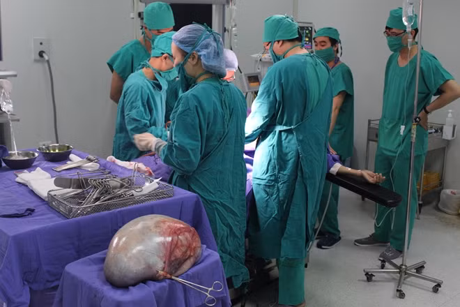 Ca phẫu thuật cắt khối u khổng lồ