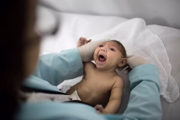 Chứng đầu nhỏ liên quan đến virus Zika Chứng đầu nhỏ liên quan đến virus Zika