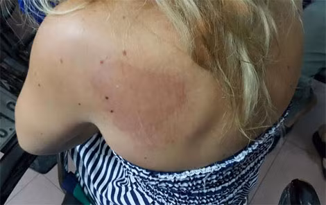 Nữ du khách với nhiều vết thương trên người.