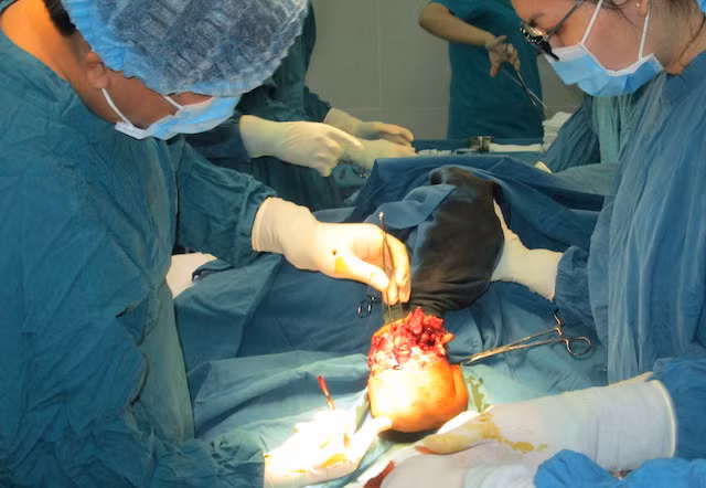 Các y, bác sĩ phẫu thuật cắt bỏ phần tay bị máy nghiền nát của bệnh nhân.