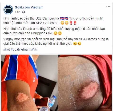 Goal đăng tải hình ảnh cho thấy các cầu thủ U22 Campuchia bị thương tích sau khi thi đấu trên mặt sân cỏ nhân tạo.