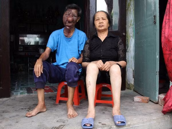 Dù đã có tuổi nhưng ông Luyện vẫn lang thang khất thực để lo cho mình và người vợ tật nguyền. Dù đã có tuổi nhưng ông Luyện vẫn lang thang khất thực để lo cho mình và người vợ tật nguyền.