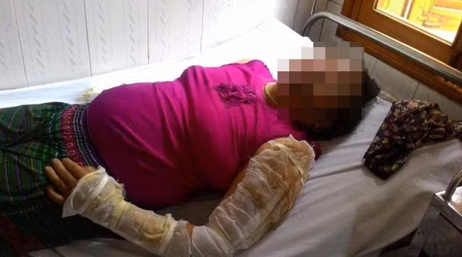 Một nạn nhân của vụ nổ.