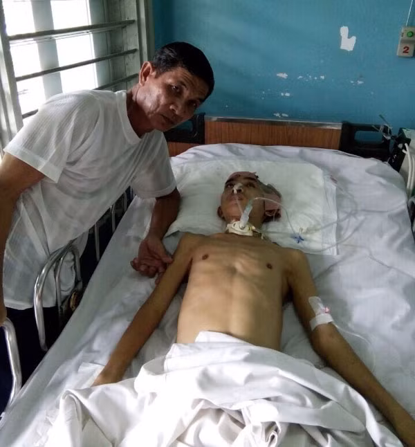 Ông Ung Văn Tùa chăm sóc con trai Ung Văn Hùng tại bệnh viện.