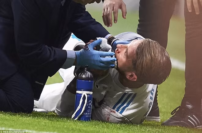 Pha đổ máu của Ramos. Ảnh: Rex.