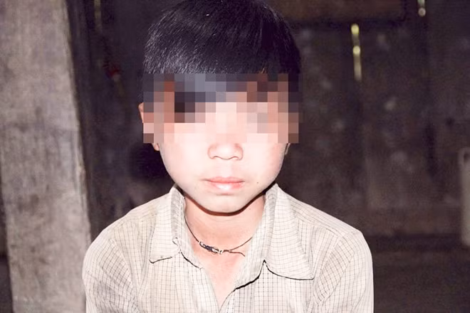 Một cậu bé có hai bộ phận sinh dục ở Yên Cường.