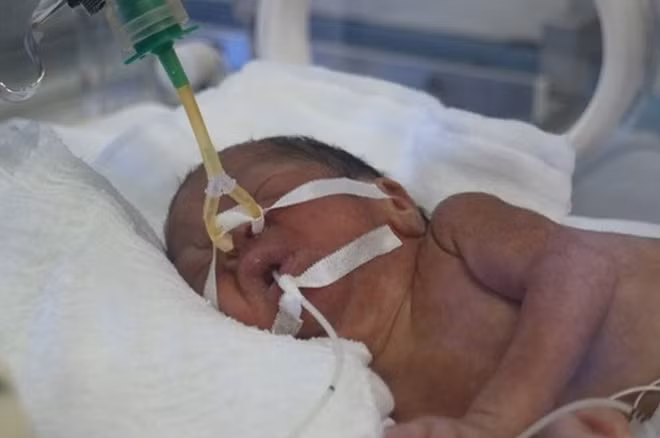 Hiện sức khỏe của bé Bình An đã khá lên nhiều.