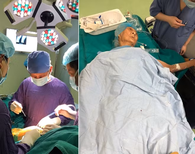 PGS.TS. Nguyễn Mạnh Khánh mổ thay khớp háng cho bà cụ 100 tuổi.