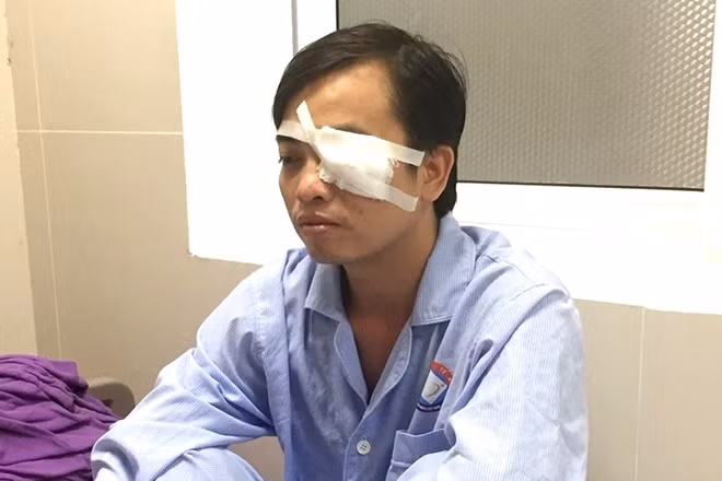 Bác sĩ Sơn - Bệnh viện Việt Nam - Cu Ba Đồng Hới (Quảng Bình) chấn thương do bị hành hung.