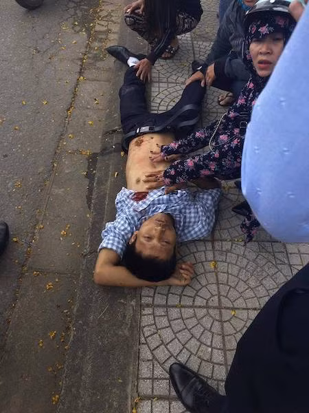 Nạn nhân Lan được đưa đi cấp cứu sau đó.