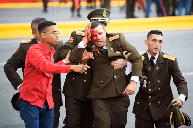 Hỗ trợ binh sỹ Venezuela bị thương tại hiện trường vụ nổ. Hỗ trợ binh sỹ Venezuela bị thương tại hiện trường vụ nổ.