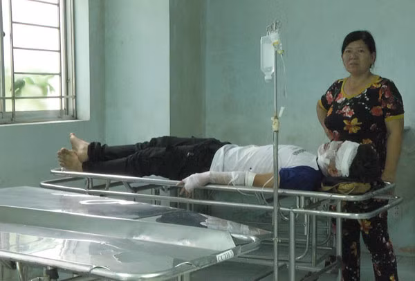 Một học sinh bị bỏng đang điều trị tại bệnh viện.