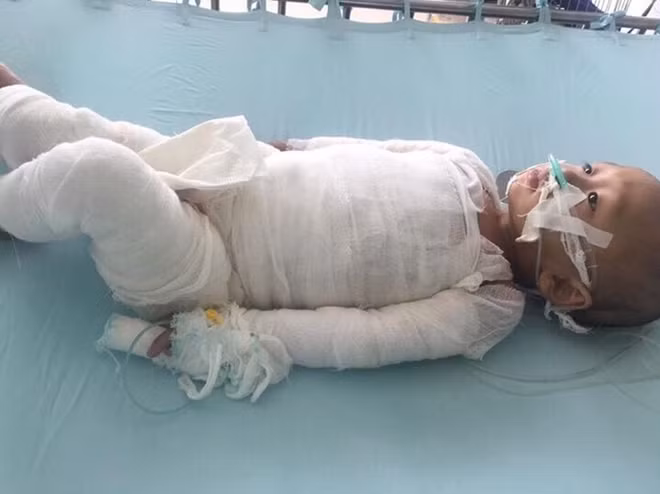 Cháu Thế khi đang nằm viện.