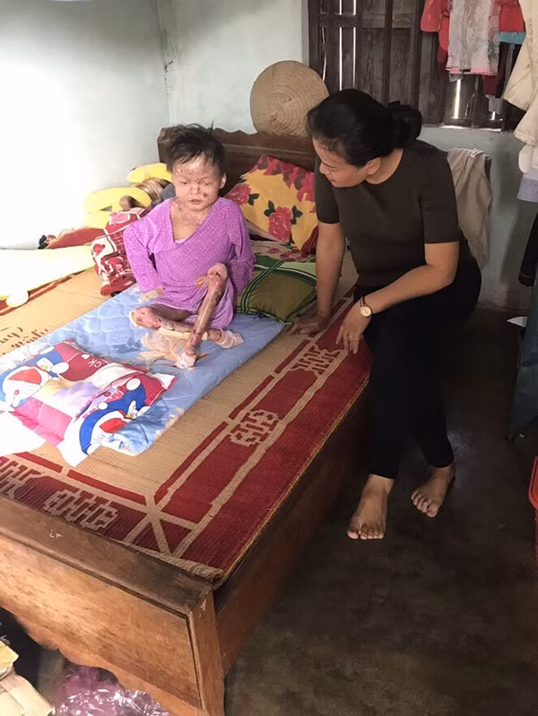 Chị Lan đến thăm một em bé EB tại Gia Lai.