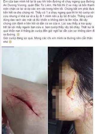 Status cùng hình ảnh cô gái bị rạch mặt được lan truyền chóng mặt trên Facebook.