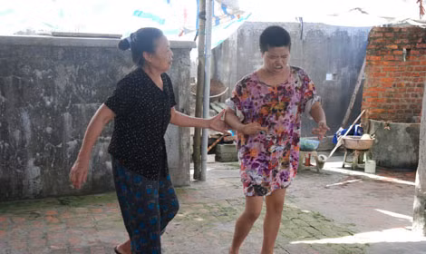 Bà Nguyễn Thị Mùi chăm sóc cô con gái 29 tuổi mắc chứng tâm thần nặng do di chứng da cam.