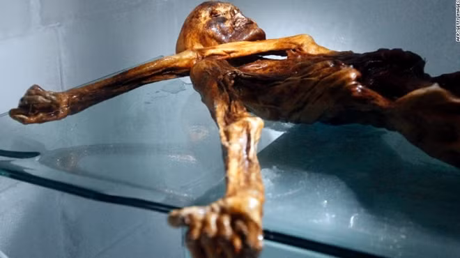 Cánh tay trái của Otzi che kín cổ họng. Đây là một trong những vấn đề các nhà nghiên cứu đã phải vượt qua.