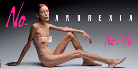 Người mẫu siêu gầy Isabelle Caro được sử dụng trong chiến dịch tuyên truyền “No Anorexia”.