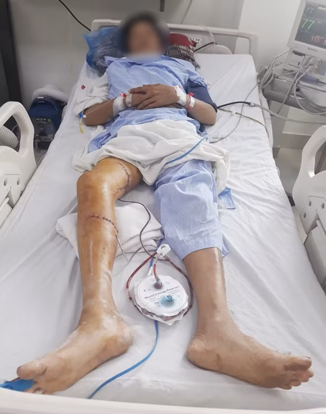 Sau mổ, bệnh nhân đã dần hồi phục: chân phải ấm, cử động được, mạch mu chân bắt rõ…