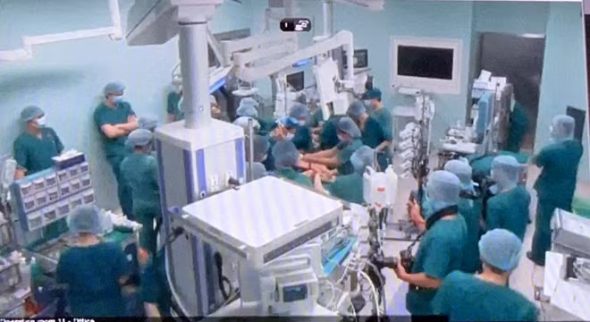 Đúng 14h7', việc tách rời hai bé đã xong.