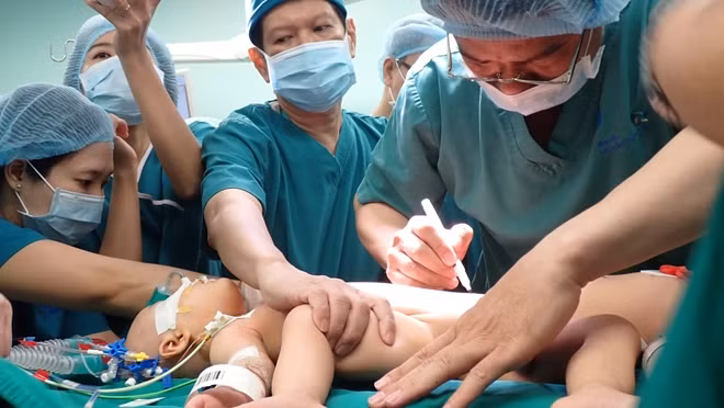 Những giây phút đầu tiên khi tiến hành vẽ trên cơ thể đánh dấu trường mổ cho hai bé
