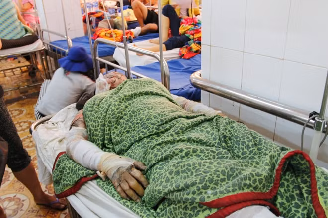 Chị Hoàng Thị Ninh (ảnh trên) và chị Hoàng Thị Khèn (ảnh dưới) khi mới nhập viện cấp cứu.