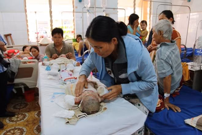 Hai cháu Quốc Anh và Quốc Đạt khi mới được nhập viện cấp cứu.