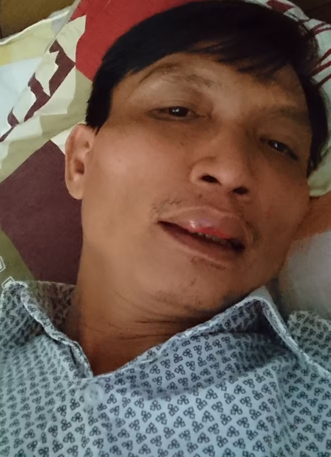 Gương mặt của ông Hưng sưng húp sau khi bị ông Truyền đánh.