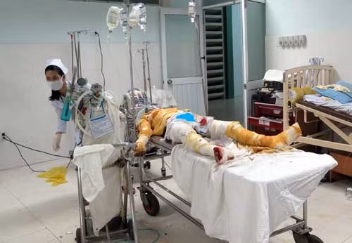 Anh Nhật phải nội thông khí quản để duy trì đường thở. Anh Nhật phải nội thông khí quản để duy trì đường thở.
